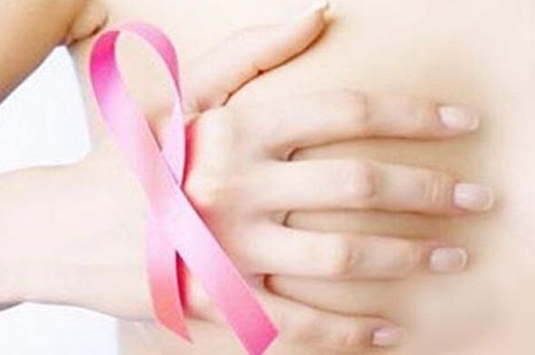 未經治療的乳腺癌并不會自發消退