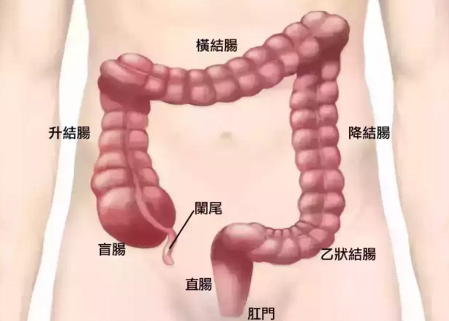 早期大腸癌有哪些癥狀