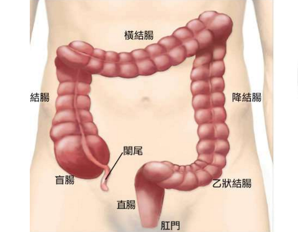 為何近四成的大腸癌都被誤診