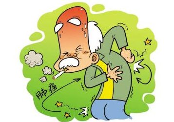 7類肺癌高危人群