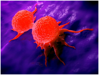 安進Blincyto適用于哪些罕見急性白血病患者？