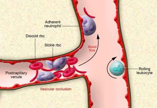 Camber Pharma推出仿制藥Captopril