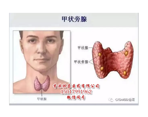 甲狀旁腺激素Natpara